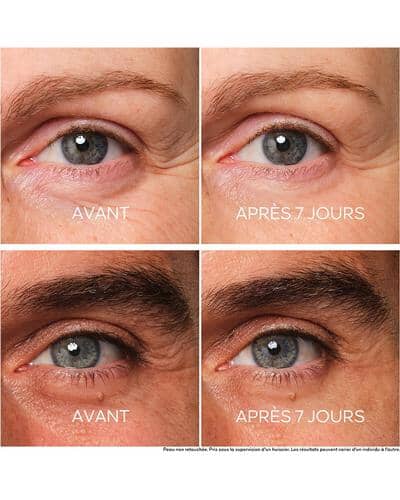 Guerlain Abeille Royale  Soin Yeux Reparateur Jeunesse фото 4